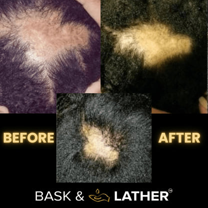 Scalp Stimulator | Hair Growth Oil